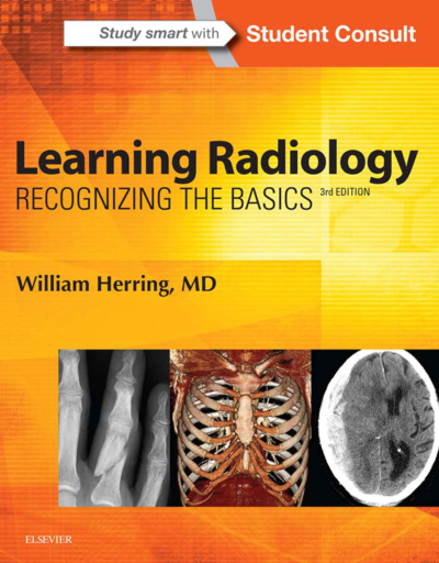 Learning Radiology: Recognizing The Basics / William Herring SegaCopy Fotokopi Merkezi